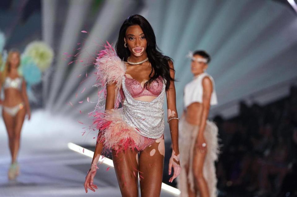 Winnie Harlow became the first model with vitiligo to walk in a Victoria's Secret Fashion Show (Getty Images)