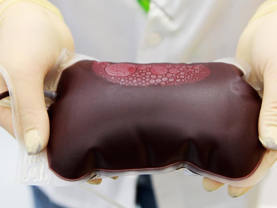 A person holding up a blood pack while wearing latex globes and a lab coat.