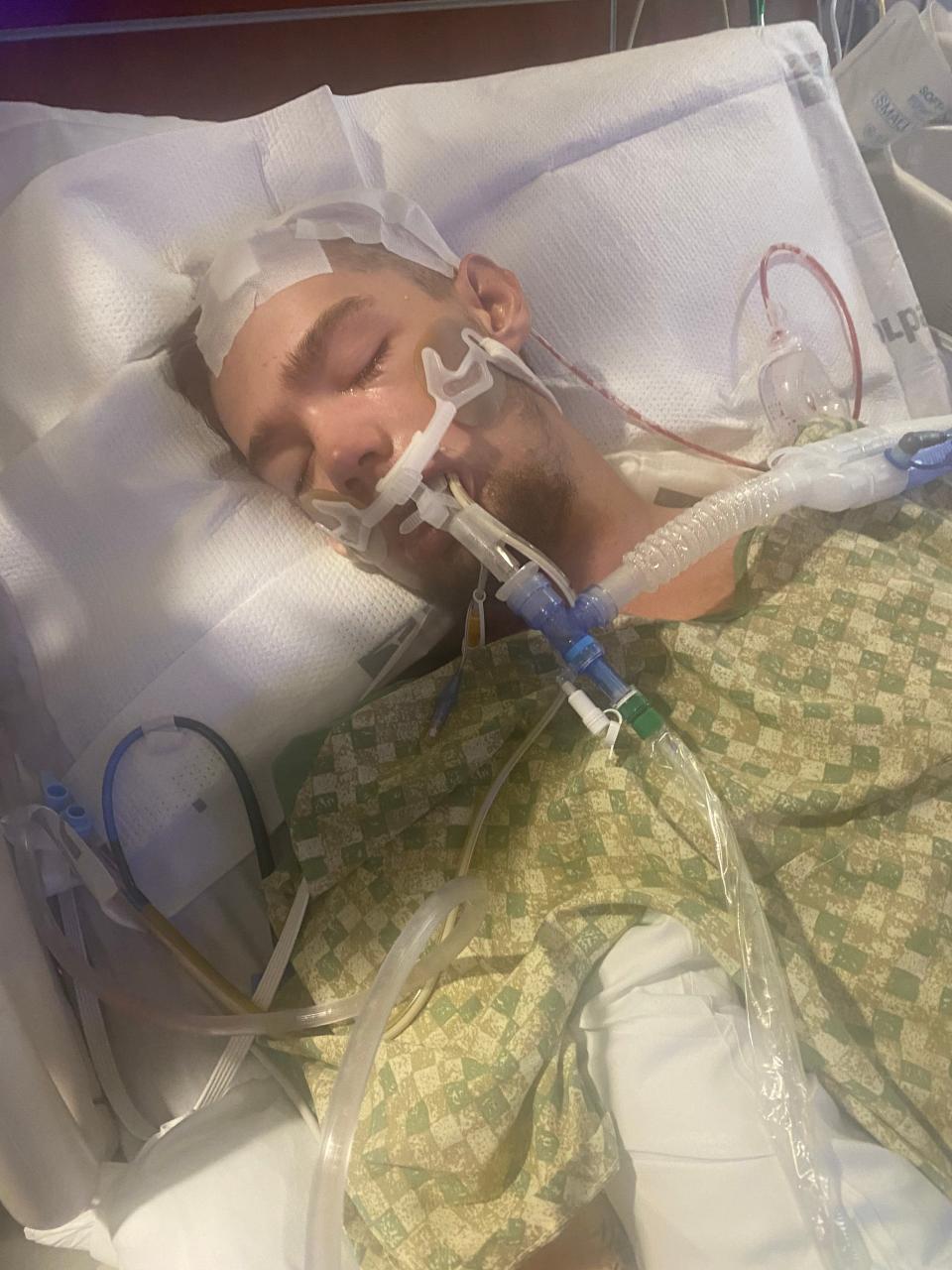 Matthew Hallahan, 21, had an intense bacterial infection in his brain that caused a stroke and seizures.