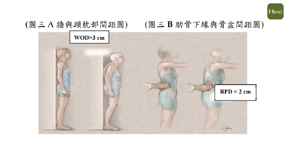 圖片來源：2021 台灣成人骨質疏鬆症防治之共識及指引