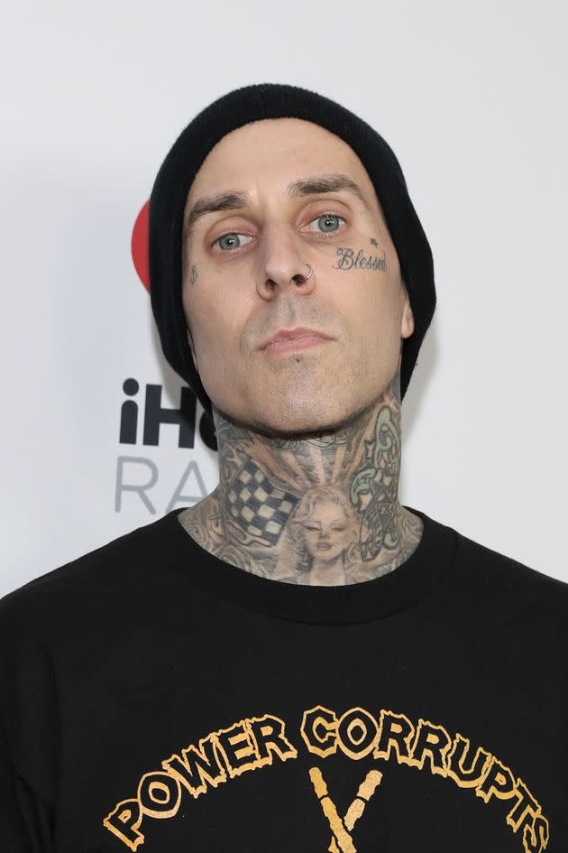 Travis Barker was hospitalized after complaining of severe abdominal pain. (Photo: Mark Von Holden/Invision/AP)