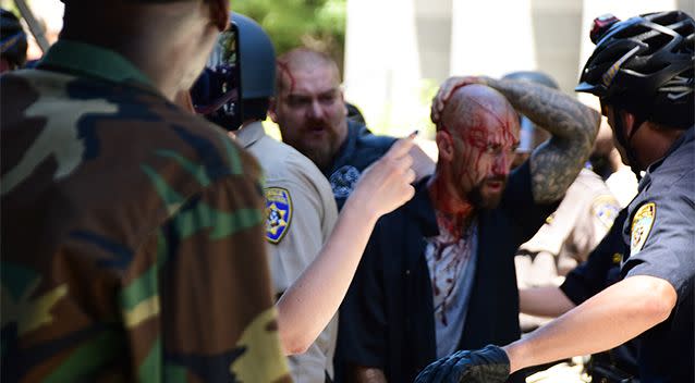 Police escort wounded man away from in front of the Capitol. Photo: AP