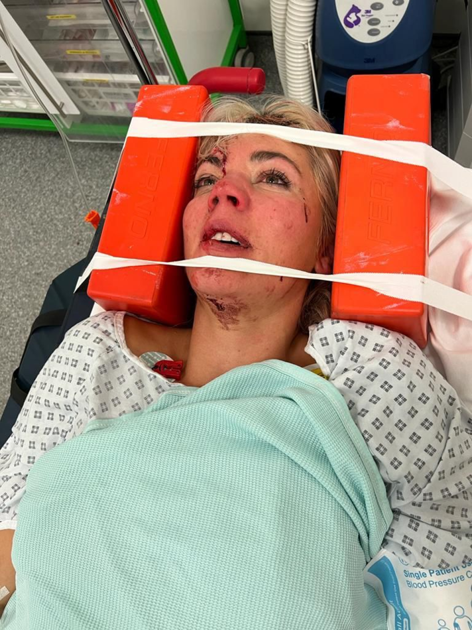 A Place in the Sun presenter Danni Menzies has been left with facial injuries after she was ‘taken out’ by a stolen moped (Danni Menzies)