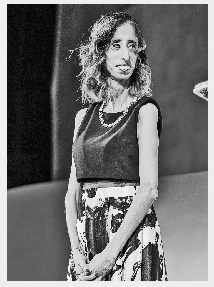 Lizzie Velasquez Speaks Out Following Cruel Meme