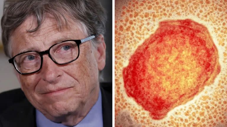 El fundador de Microsoft, Bill Gates, había alertado meses atrás sobre la aparición de focos de viruela en el mundo causados por ataques bioterroristas