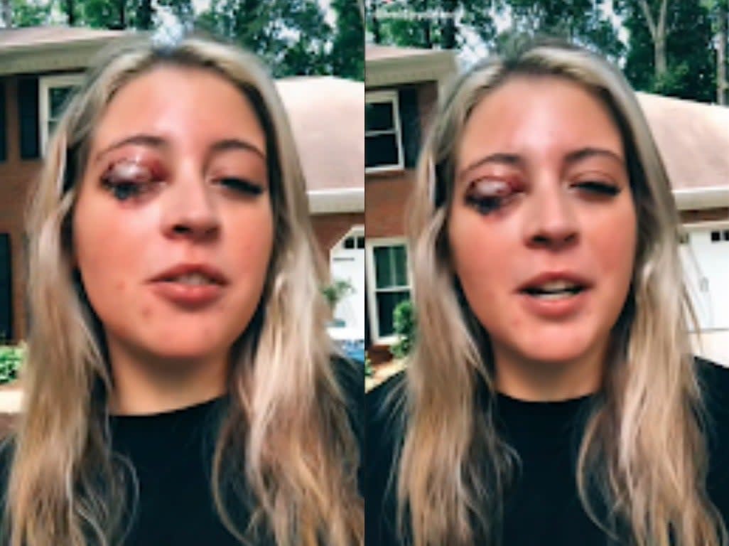 Kelsey Salmon went viral on the video-sharing platform after telling her followers the gruesome story (TikTok)