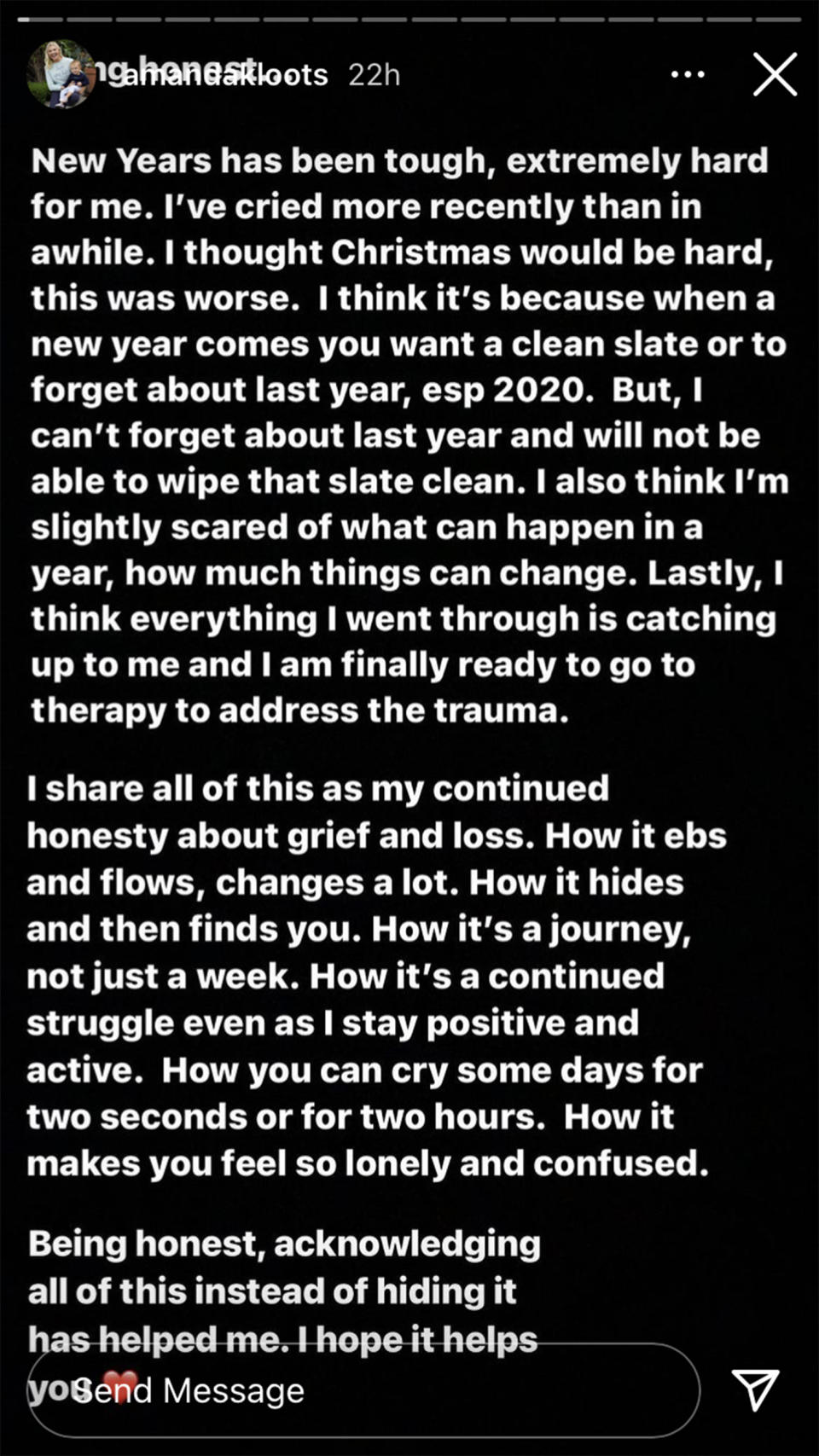 Kloots opened up about her desire to go to therapy. (amandakloots/Instagram)