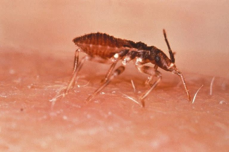 La transmisión ocurre cuando la vinchuca defeca en la piel de una persona, que lleva a que esta se rasque y permita así la entrada del parásito Trypanosoma cruzi, causante de la afección