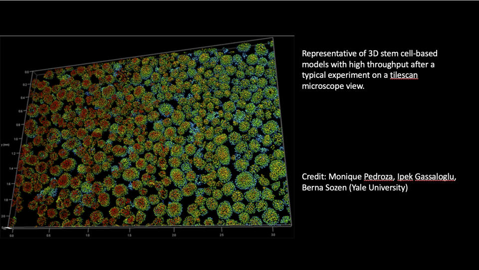 This graphic provided by Yale University shows an image of a human embryo model. (Monique Pedroza, Ipek Gassaloglu, Berna Sozen/Yale University via AP)