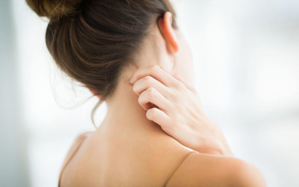 eczema skin flare up summer suffer heatwave hot - GARO/Getty Images