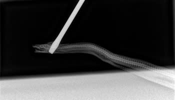 An X-ray shows a snake impaled with a screwdriver.