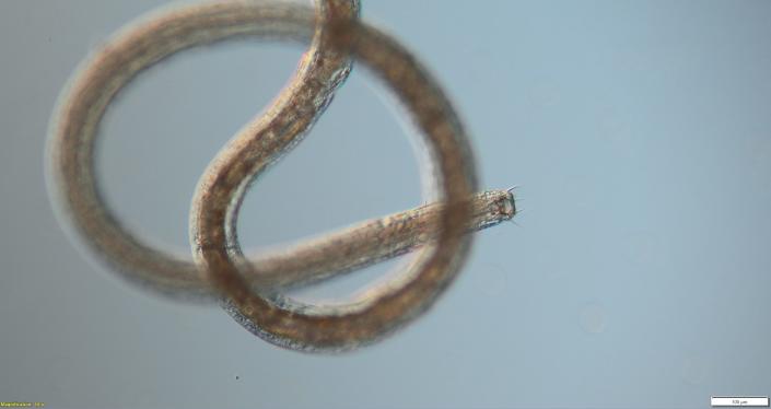 Imagen microscópica del nematodo Pareurystomina.