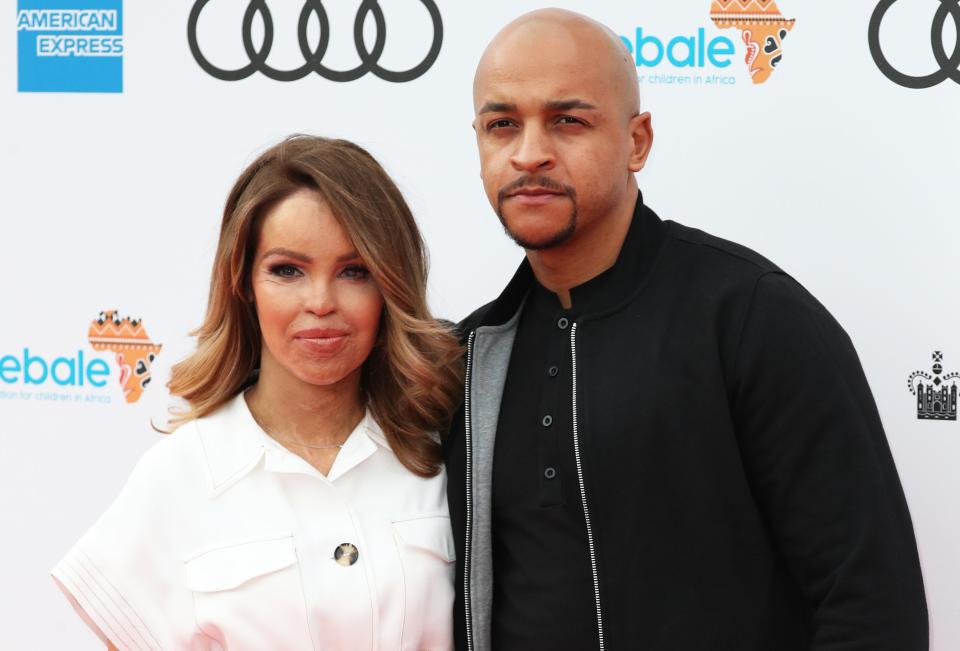 Katie Piper and husband Richard Sutton have two daughters. (Getty Images)