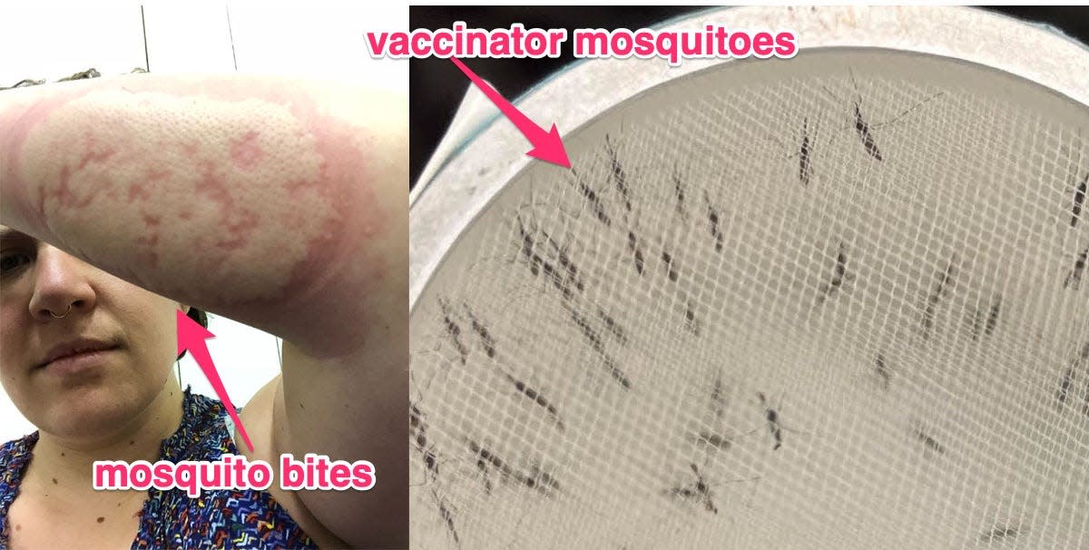 side by side photos of woman with lots of mosquito bites on her arm / malaria vaccine-carrying mosquitos under mesh