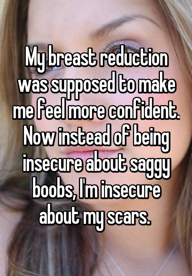 I feel more confident after getting a breast reduction