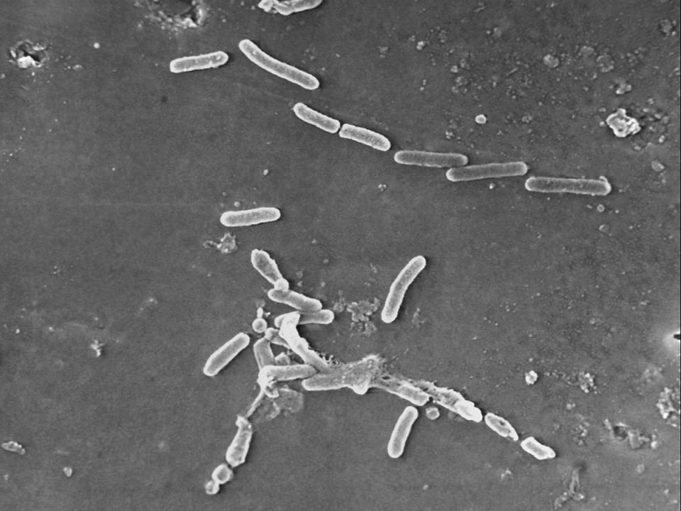 This scanning electron microscope image made available by the Centers for Disease Control and Prevention shows rod-shaped Pseudomonas aeruginosa bacteria. U.S. officials are reporting two more deaths and additional cases of vision loss linked to eyedrops tainted with the drug-resistant bacteria. The eyedrops from EzriCare and Delsam Phama were recalled in February 2023 and health authorities are continuing to track infections as they investigate the outbreak. (Janice Haney Carr/Centers for Disease Control and Prevention via AP, File) (AP)