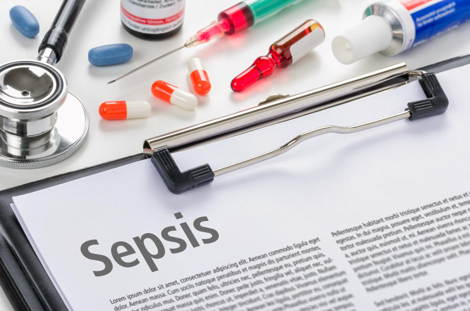 The diagnosis Sepsis written on a clipboard. Between 20 to 30 per cent of individuals with sepsis do not survive their hospital stay, the expert says. (Getty)