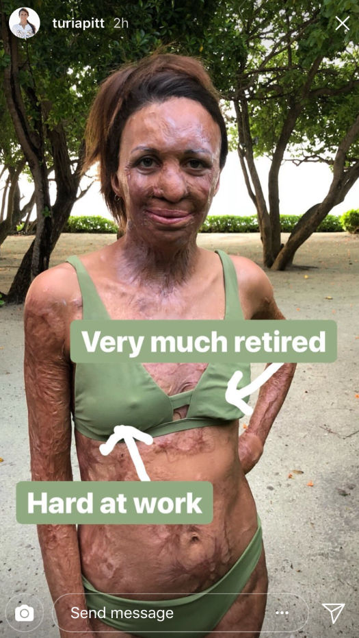 Turia Pitt has shared a brutally honest photo about the realities of breastfeeding. Source: Instagram/TuriaPitt