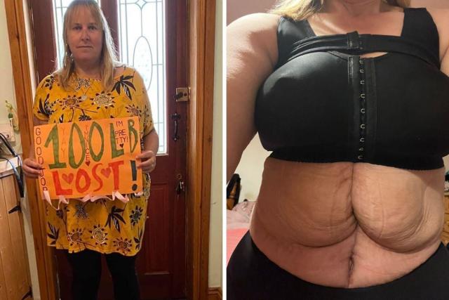 Mum-of-six in 'agonising pain' and 'lumpy' after botched Turkey tummy tuck
