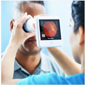 Health worker takes a photo of a patient’s eye that will be examined remotely by an ophthalmologist to determine if the patient has a blinding disease.