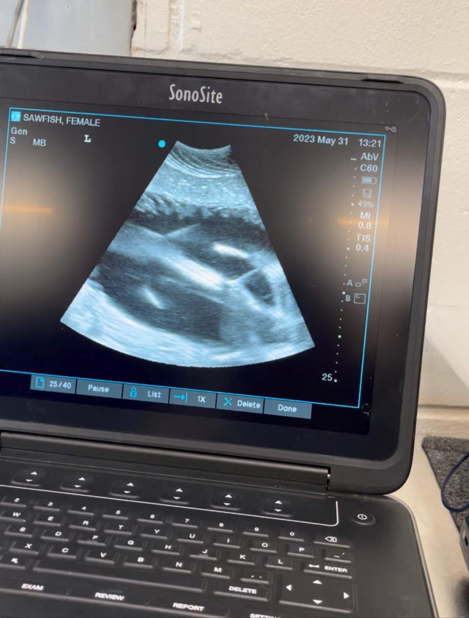 In late May, SeaWorld Orlando's veterinary teams discovered through ultrasound that the female sawfish was pregnant.