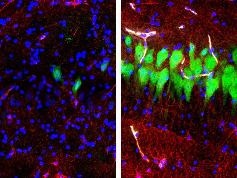 Pigs' brains partially revived four hours after death with synthetic blood machine