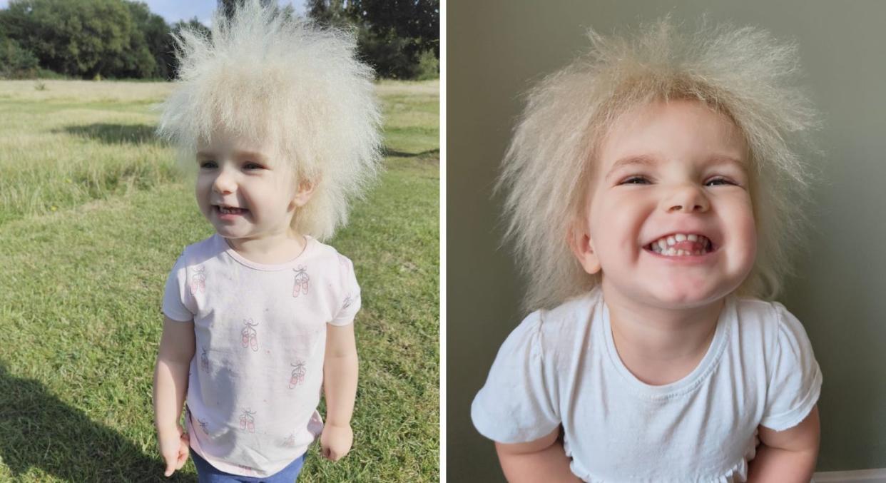 Layla Davis, 3, is one of only 100 people in the world with 'uncombable hair syndrome. (Charlotte Davis/SWNS)