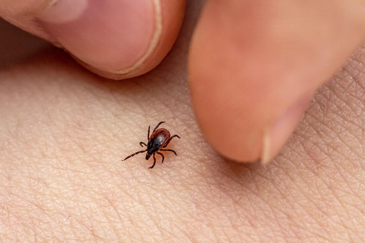 <span class="caption">As the rate of tick-borne diseases rises, vaccines that stop ticks in their tracks could be an essential preventive tool.</span> <span class="attribution"><a class="link " href="https://www.gettyimages.com/detail/photo/the-fingers-of-the-hand-catch-an-encephalitis-royalty-free-image/1289080738" rel="nofollow noopener" target="_blank" data-ylk="slk:rbkomar/Moment via Getty Images;elm:context_link;itc:0;sec:content-canvas">rbkomar/Moment via Getty Images</a></span>