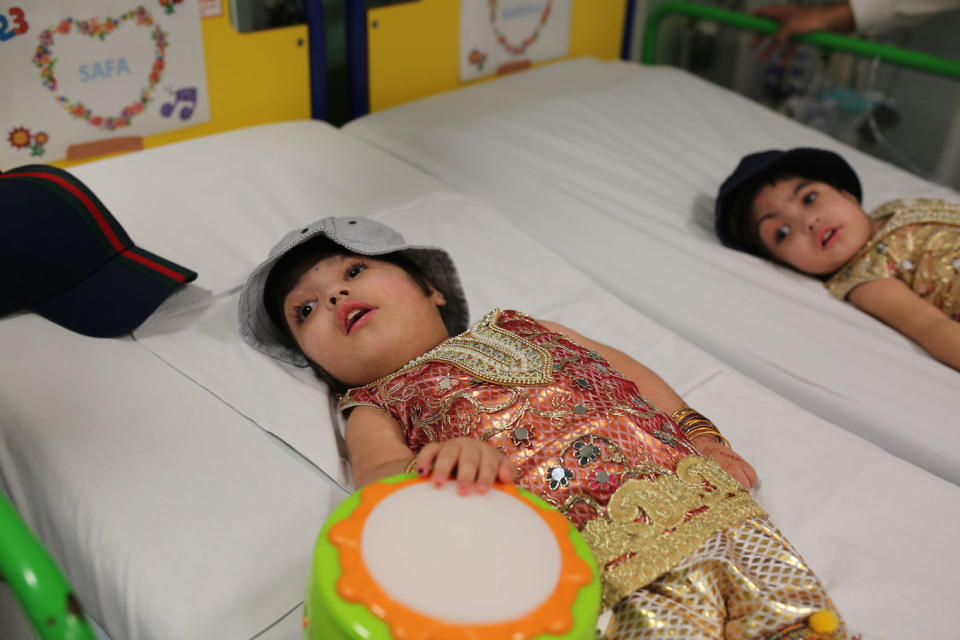 Undated handout photo issued by Great Ormond Street Hospital of two-year-olds Safa and Marwa Ullah, from Charsadda in Pakistan, after a surgery to separate their heads at the hospital in London. PRESS ASSOCIATION Photo. Issue date: Monday July 15, 2019. The sisters, who were craniopagus twins, underwent three major operations to separate their heads at Great Ormond Street. The last operation, which saw the girls finally separated, took place on February 11 this year. See PA story HEALTH Twins. Photo credit should read: Great Ormond Street Hospital/PA Wire  NOTE TO EDITORS: This handout photo may only be used in for editorial reporting purposes for the contemporaneous illustration of events, things or the people in the image or facts mentioned in the caption. Reuse of the picture may require further permission from the copyright holder. 