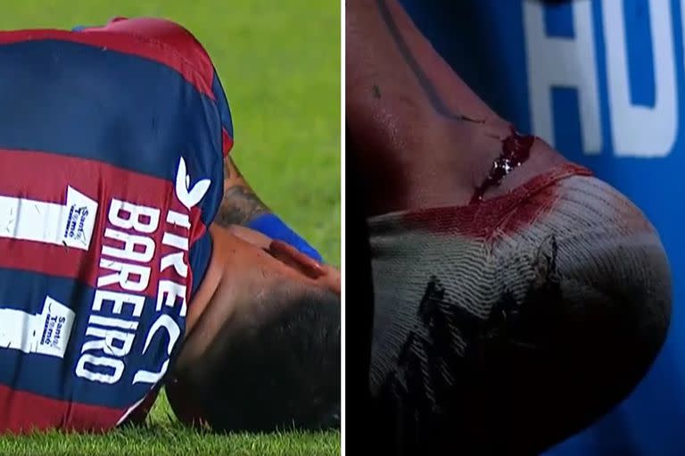 Adrian Bareiro sufrió un corte en su tobillo izquierdo, requirió seis puntos de sutura y fue reemplazado en el complemento