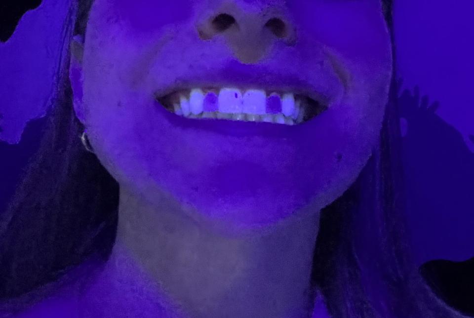 Close-up of a person's smiling mouth under blue light