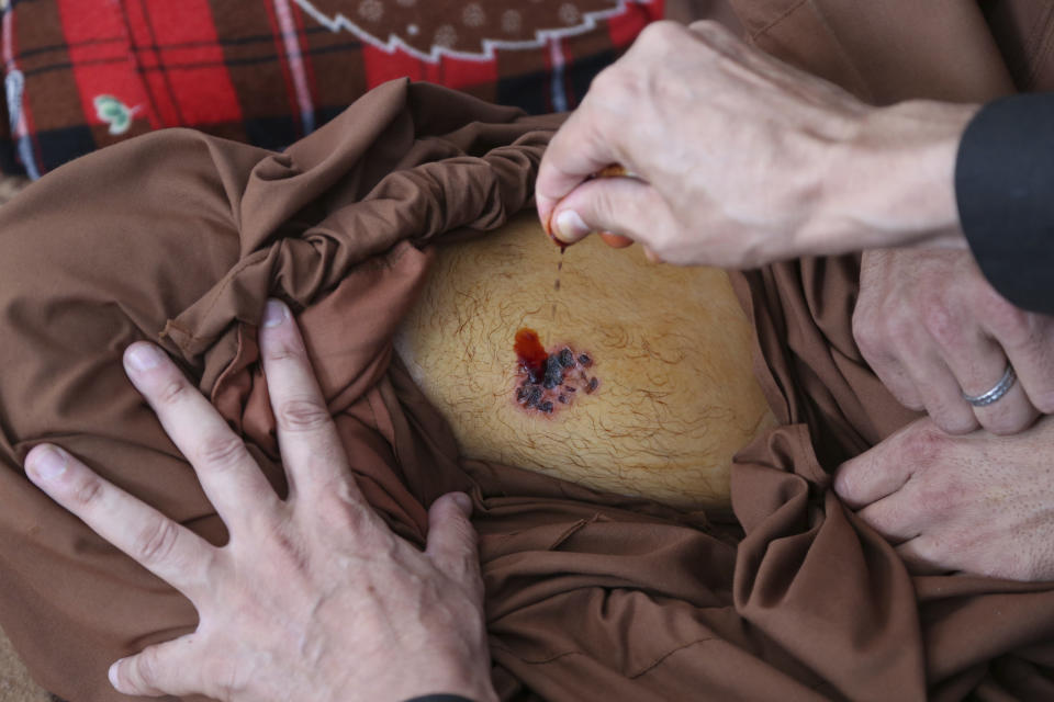 In this Thursday, Aug. 29, 2019, photo, Sayed Rahim Omid, 23, a peace marcher show his painful wound during an interview with the Associated Press in Kabul, Afghanistan. A 23-year-old member of the peace movement, Sayed Rahim Omid, shyly lowered his trousers and showed The Associated Press a still-painful wound on his leg where he said Taliban members at home in southern Helmand province had whipped him with cables. Stop your activism, they told him last month. Who's paying you? (AP Photo/Rahmat Gul) .