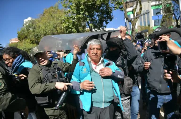 El alcalde de La Paz, Iván Arias (partidario del presidente Luis Arce), herido de un piedrazo en el rostro (Agencia Municipal de Noticias de La Paz)