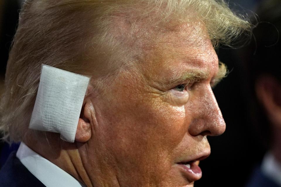 Former President Donald Trump sporting a huge bandage on the first day of the Republican National Convention in Milwaukee.