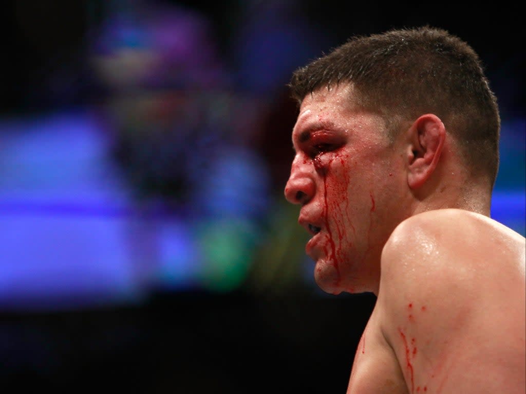 Nick Diaz during his last bout, against Anderson Silva in 2015 (Getty Images)