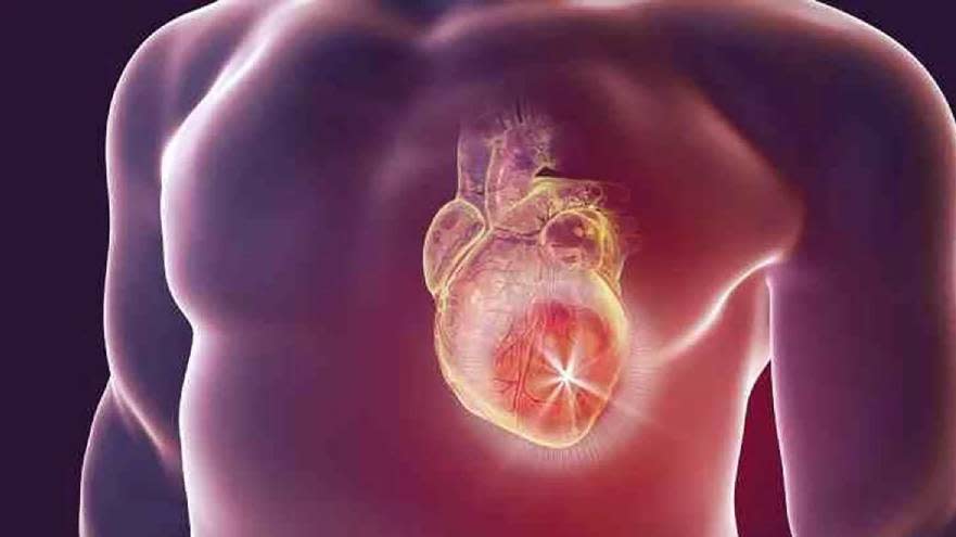 Exceso de ejercicio o l riesgo de desencadenar un infarto de miocardio o muerte súbita