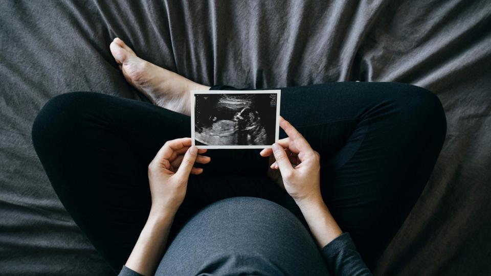 PHOTO: Among younger women with breast cancer, new research suggests it may be possible for many to have a baby after their diagnosis, thanks to advances in breast cancer care. (STOCK PHOTO/Getty Images)