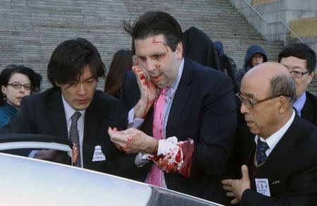 U.S. Ambassador to South Korea Mark Lippert leaves after he was slashed in the face by an unidentified assailant at a public forum in central Seoul March 5, 2015. REUTERS/Yonhap