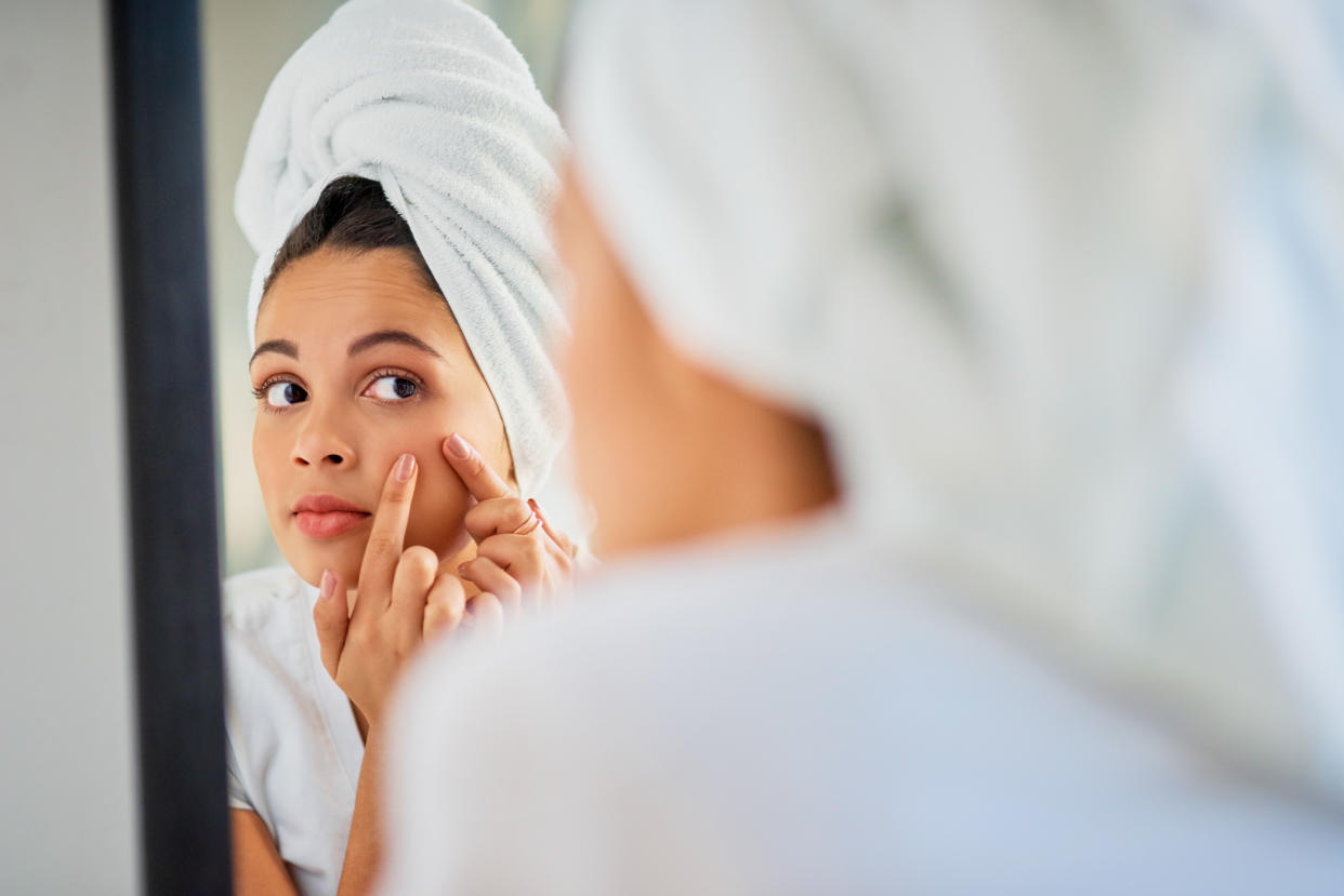 An unwanted zit comes at the worst times. I'm confident in saying I've found the product that can fight those breakouts in one night. (Photo: Getty Images)