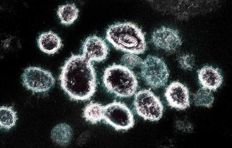 Imagen de un microscopio electrónico, proporcionada por el Instituto Nacional de Alergias y Enfermedades Infecciosas, que muestra el SARS-CoV-2, el virus que causa la COVID-19, aislado de un paciente en Estados Unidos. (Cortesía de NIAID para The New York Times)