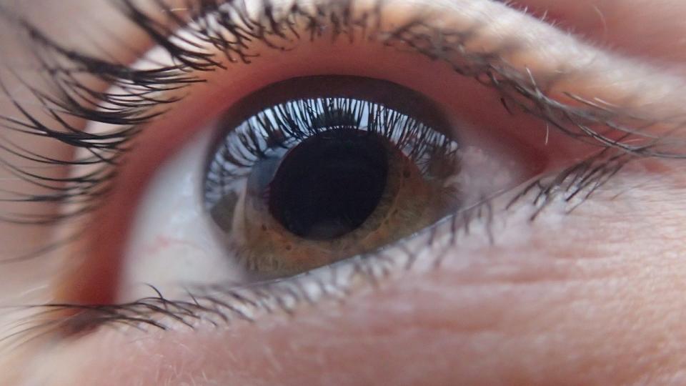 20多年前，戈拉傑因過敏反應導致雙眼近乎全盲。（示意圖／pixabay）