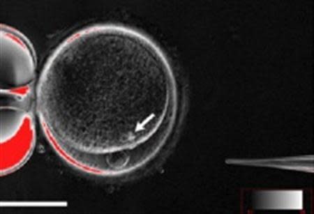 A handout picture shows the process by which scientists created patient-specific stem cell lines out of the skin cells of two adult men. REUTERS/Robert Lanza/Advanced Cell Technology/Handout