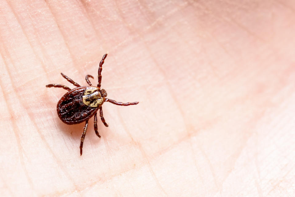 A tick on a hand. (Getty Images)