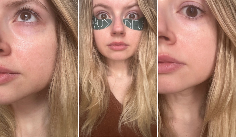 before and after photos of the author while trying the under-eye masks, along with a photo of her wearing them