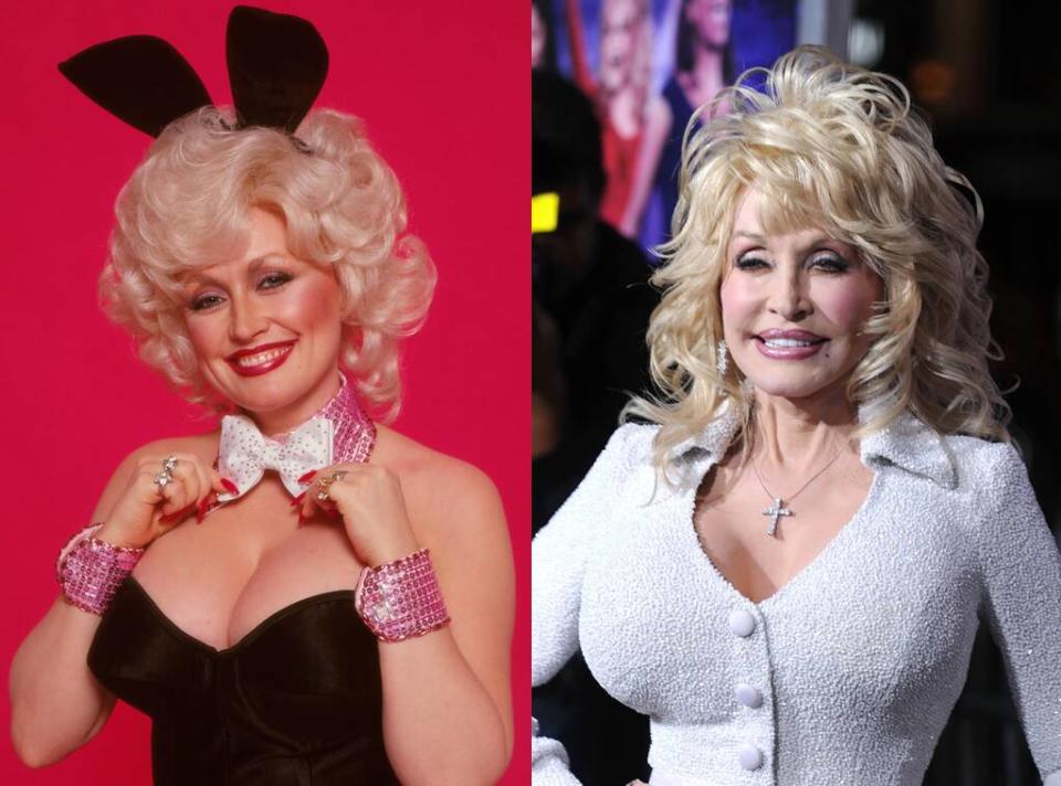 Dolly Parton, Plastic Surgery