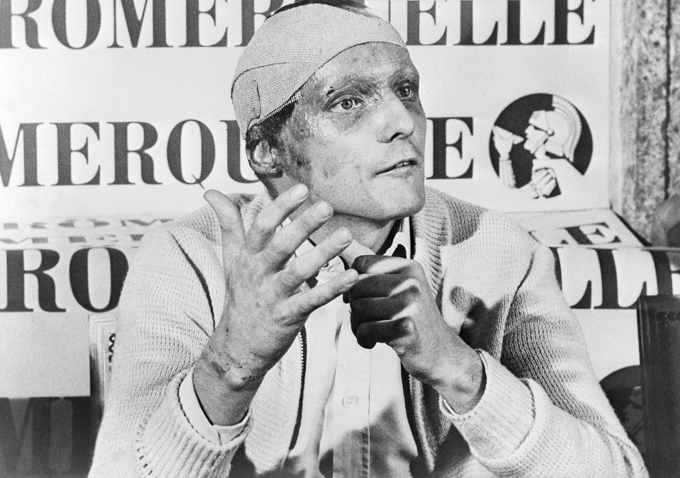 FILE - In this Sept. 12, 1976 file photo Austrian auto racer Niki Lauda, following his near fatal crash at the German Grand Prix six weeks ago, announces he would start at the Italian Grand Prix at Monza. Three-time Formula One world champion Niki Lauda, who won two of his titles after a horrific crash that left him with serious burns and went on to become a prominent figure in the aviation industry, has died. He was 70. (AP Photo, File)