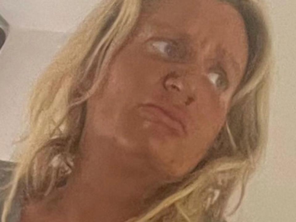 Daisy May Cooper asked her fans for help after staining her face with 20-year-old fake tan (Instagram)