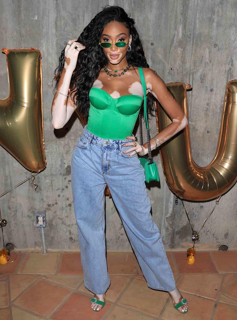 Winnie Harlow