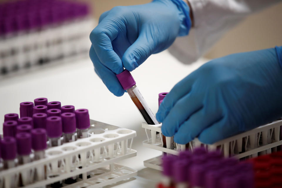 A staff member works on coronavirus serology tests at the Biogroup-LCD laboratory's technical platform in Levallois-Perret, near Paris, France. (Photo: Benoit Tessier / Reuters)