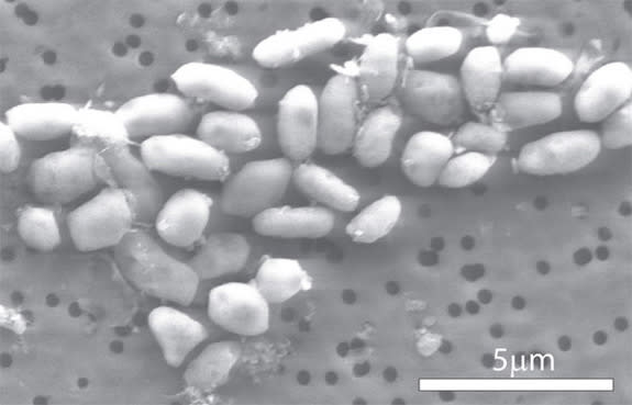 This scanning electron micrograph shows a strain of the arsenic-eating bacterium called GFAJ-1.